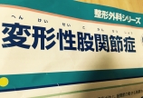 変形性股関節症
